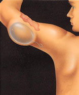 Expansion is also used to repair skin on the head and neck, hands, arms, and legs.