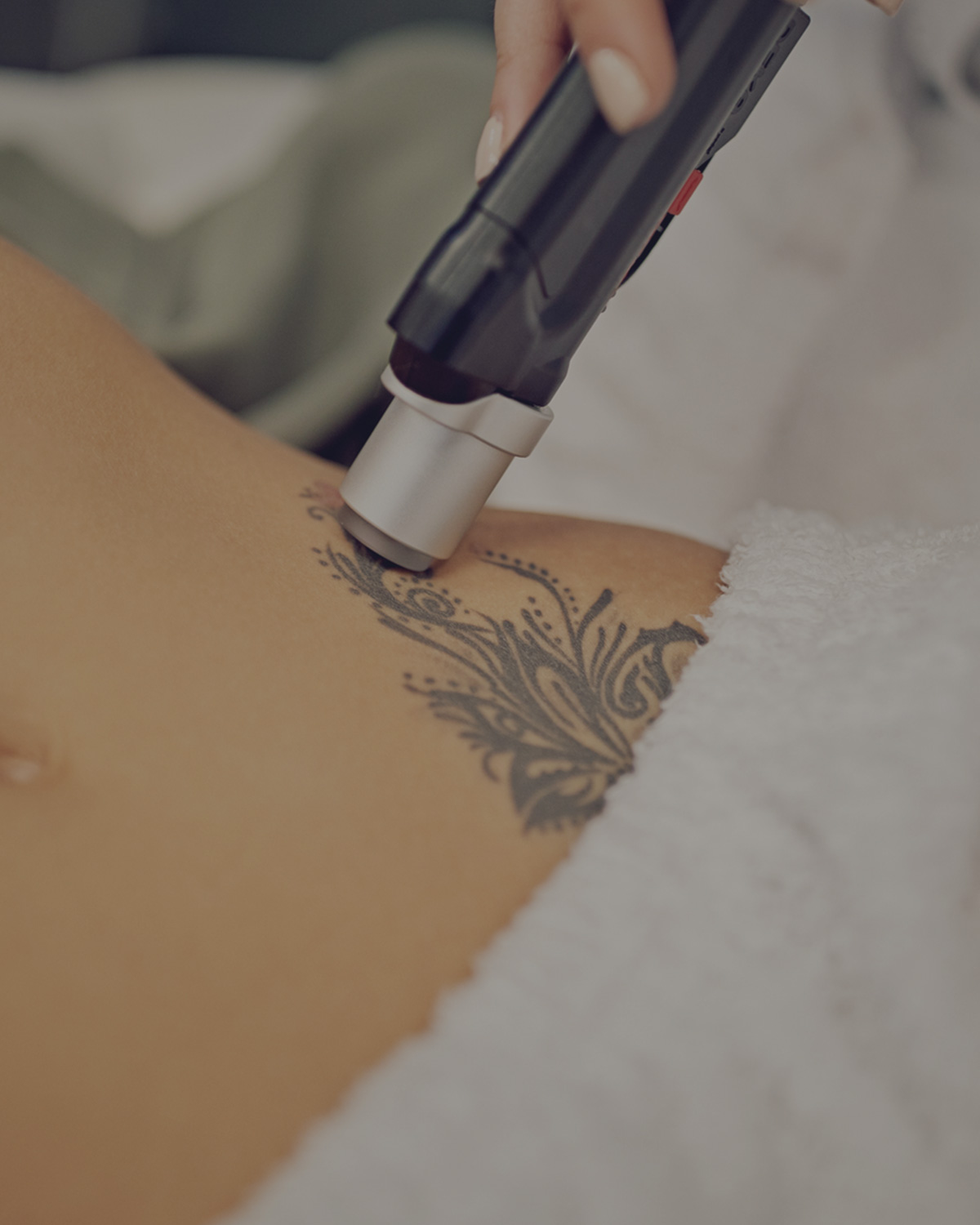 Laser Tattoo Removal Aftercare, Treatment and Instructions | Blog
